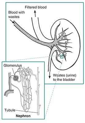 Glomerular Diseases | NIDDK