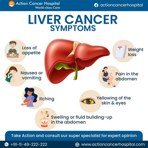 Liver Cancer Symptoms, Causes, Types, Complications,, 49% OFF