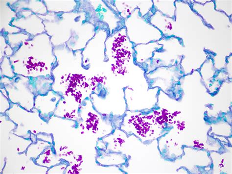 Fungus, PAS, Candida Histology Slides, Artificial