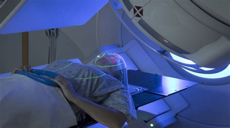 Radiation Therapy for Brain Cancer Treatment | Onco.com