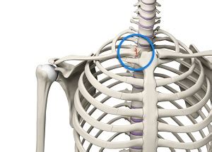 Sternoclavicular Joint Injury Nashville, Wilson County | SC Joint Injury Lebanon TN