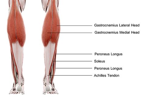 How to Manage an Achilles Tendon Rupture - Sport & Spinal Physiotherapy