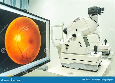 Fundus Camera Use for Examination Eye in Hospital Stock Photo - Image of optometry, exam: 67907168