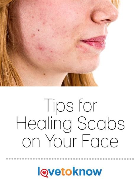 Healing Scabs on Your Face | LoveToKnow Health & Wellness | Scab ...