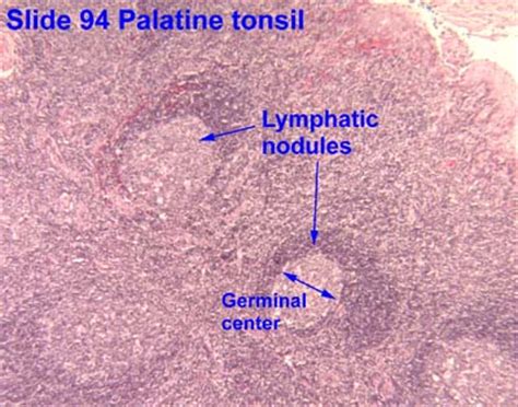 Lymphoid