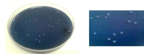 Isolated oral Streptococcus from dental plaque in Mitis-Salivarius agar... | Download Scientific ...