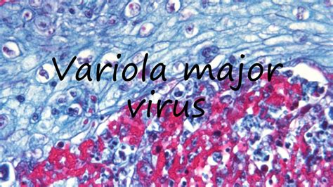 How to Pronounce Variola major virus? - YouTube