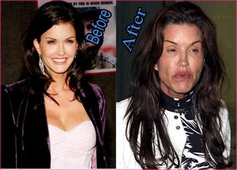 Top 25 Celebrities Before And After Plastic Surgery And Nose Jobs - My ...