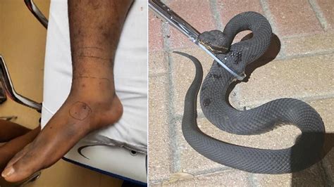 Florida man bitten by venomous snake outside of home | FOX 29 Philadelphia