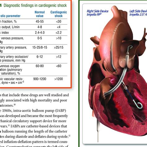 Nursing considerations: management of Impella devices | Download ...