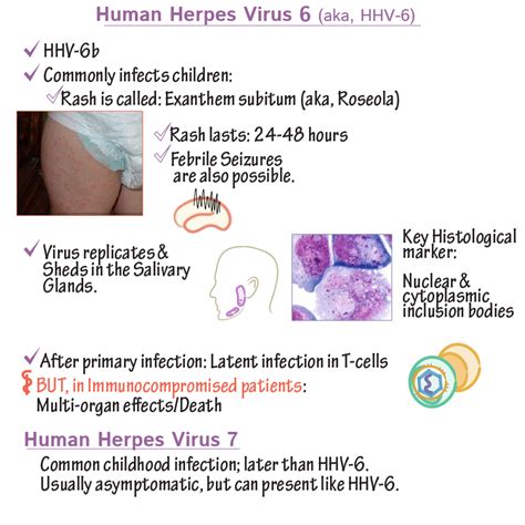 Human Herpesvirus 6 Hhv 6 Has the Following Characteristics Except