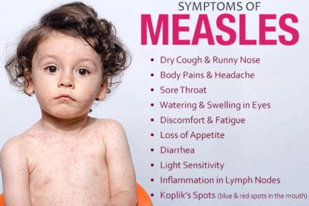 Measles: Types, Symptoms, Treatment, and Vaccinations