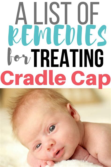 Cradle Cap: Home Remedies to Get Rid of It! – Oh Baby Love | Cradle cap ...