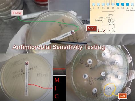 Antimicrobial Susceptibility Testing (AST): Introduction, Methods, Procedu