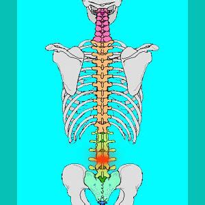 Herniated Disc L3-L4 - Herniated Disc