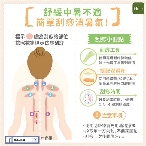 炎熱夏天如何舒緩中暑不適 一張圖秒懂怎麼刮痧消暑氣 | 中醫精髓 | 養生 | 元氣網