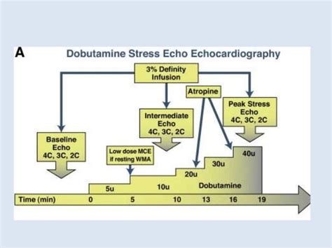 Dobutamine stress echo in myocardial viability assessment