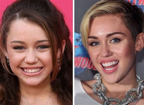 Celebrity Teeth Six Best Dental Before and After Makeovers