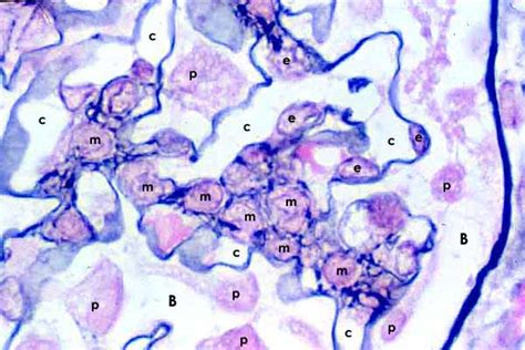 Mesangial Cell Histology