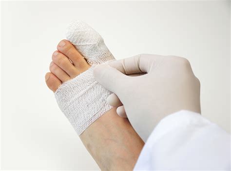 Common Symptoms and Treatment of a Fractured Toe