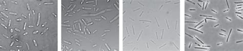 Phase-contrast microscopic analysis of sporulating Clostridium ...