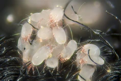 House dust mites | House dust mites (Dermatophagoides pteron… | Flickr