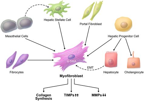 Origin and role of hepatic myofibroblasts in hepatocellular carcinoma ...