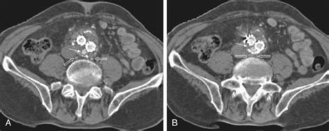 CT scan – Brian's Radiology Learning Diary