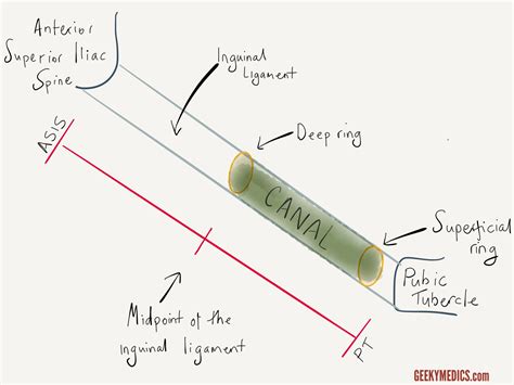 Hernias Explained | Inguinal Canal Anatomy | Geeky Medics