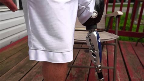 AmputeeOT: How An Above Knee (AK) Prosthetic Leg Works - YouTube