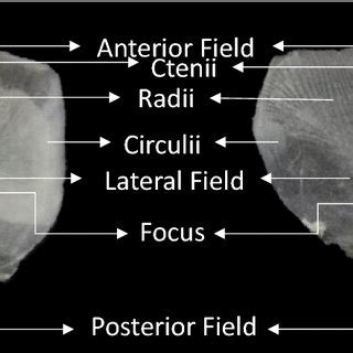 Morphology of the ctenoid scales from Argyrosomus thorpei (Photo by ©L.... | Download Scientific ...