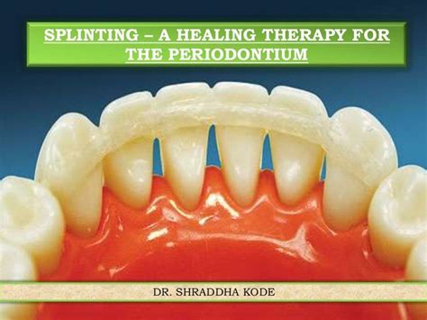 Dental splinting