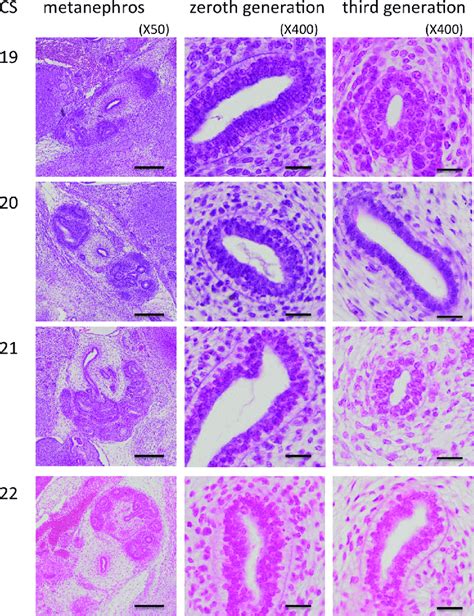 Renal pelvis histology during the embryonic period. Numbers indicate ...