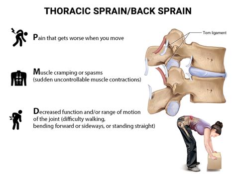 Thoracic Sprain/Back Sprain Doctors NJ & NYC