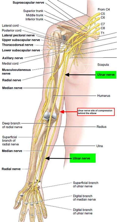 Pinched Nerve - In Neck, Arm, Shoulder - Causes, Symptoms & Treatment