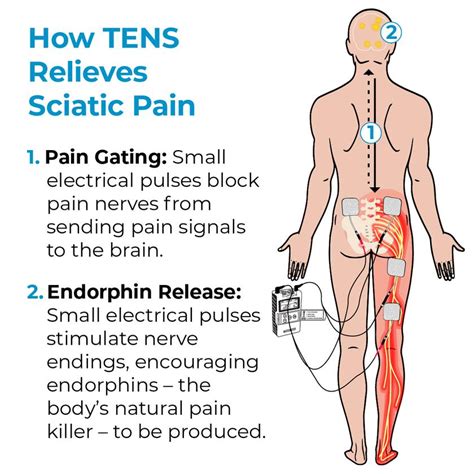 TENS Unit and Sciatica Pain Relief – TENS 7000