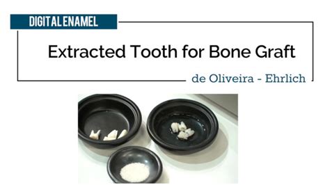 CosmoBioMedicare Bone Graft Process - Digital Enamel