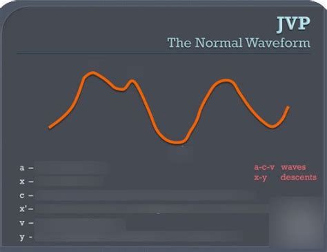 Diagram of Normal JVP waveform- labelled | Quizlet