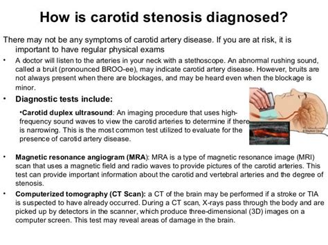 Carotid artery disease