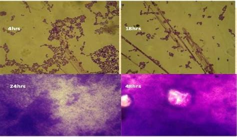 a, b, c, d Examination by light microscope(100X) of biofilm formed on ...