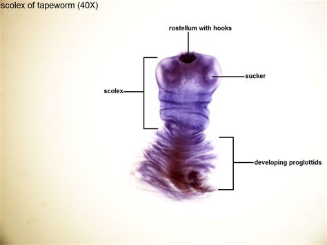 L- Tapeworm Scolex 40X-1