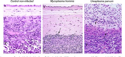 Congenital and opportunistic infections: Ureaplasma species and Mycoplasma hominis. - Semantic ...