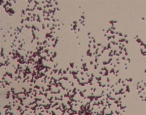 Morphology of lactic acid bacteria samples (1000x magnification). | Download Scientific Diagram