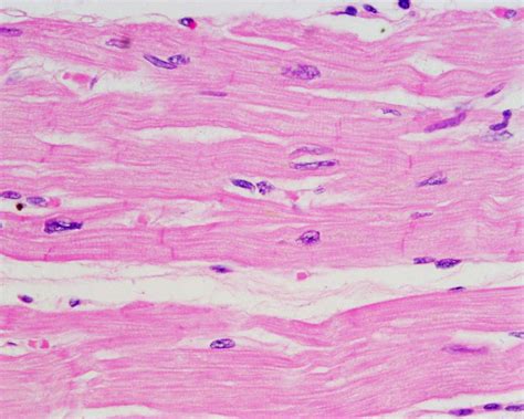 Cardiac Muscle Histology Heart Histology Slide - vrogue.co