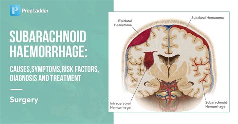 Subarachnoid Haemorrhage: Causes, Symptoms, Risk Factors, Diagnosis and Treatment