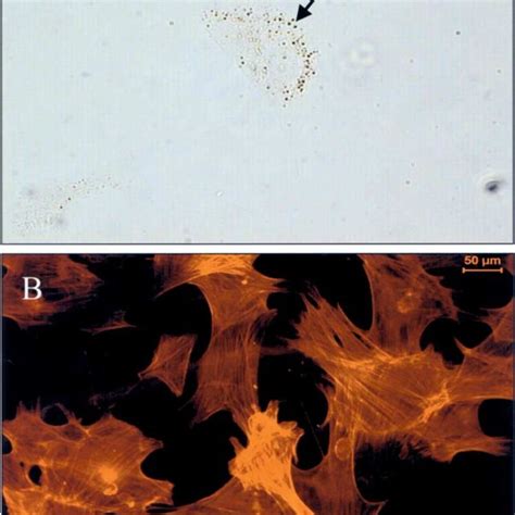 Phase contrast images of rat hepatic stellate cells in culture. (A) 24... | Download Scientific ...