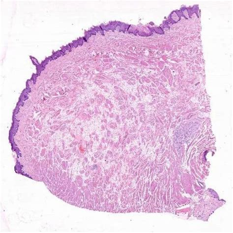 Oral Histology Slide - Fungiform Papillae Tongue at Rs 800/piece | Prepared Microscope Slide in ...