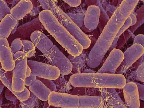 Bacteroides ~ Detailed Information | Photos | Videos