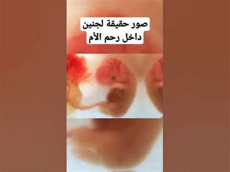 صور جنين داخل رحم الأم - YouTube