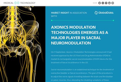 Axonics Modulation Technologies emerges as a major player in sacral neuromodulation - Medical ...